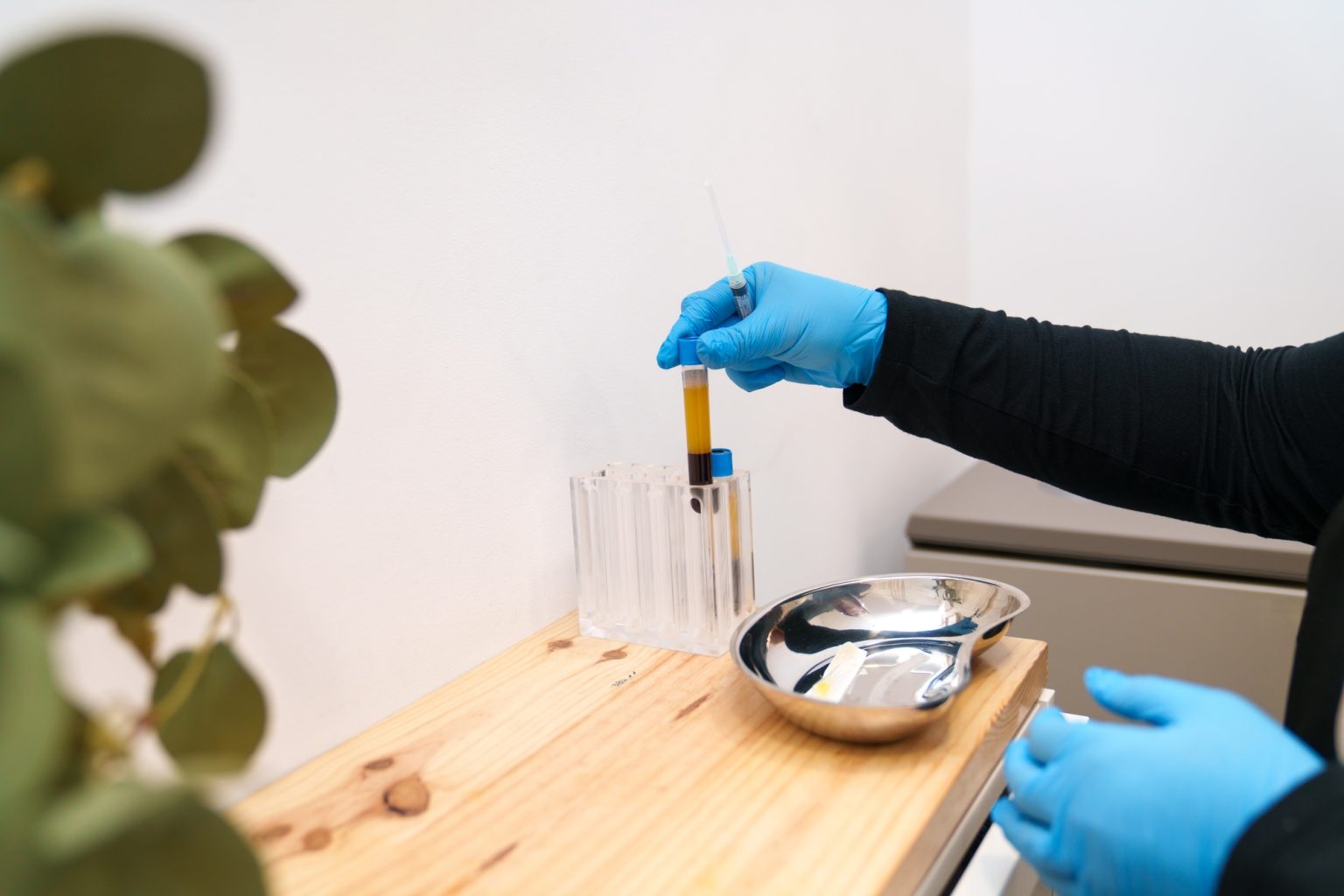 Medical Professional Preparing Blood Components for PRP Therapy
